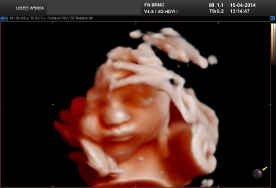 3D oblicej 30 tyden fetorealistk