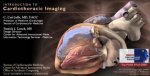 Cardiothoracic