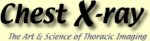 Chestxray