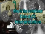 chestCT