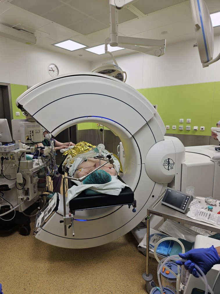 Cone beam CT