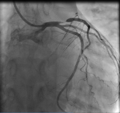 Mužská erekce barometrem zdraví