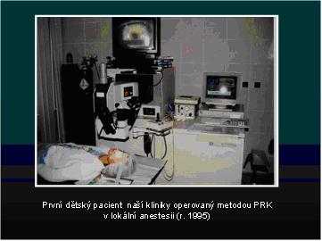 Princip funkce excimer laseru III.JPG