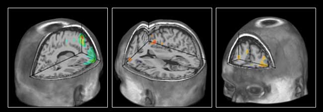 Lidský mozek.jpg